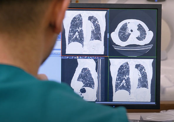 Radiologist looking at a lung screening scan image