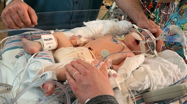 A newborn baby receiving medical help