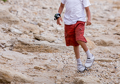 Boy walking with clubfoot defect