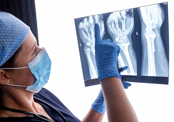Hand and Wrist Fracture