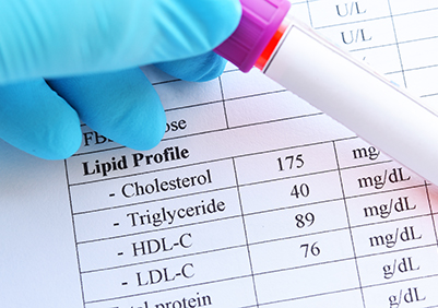 Lipid blood test results